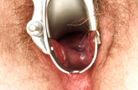 Nasty chubby granny gets her hairy cunt spread wide at the gyno
